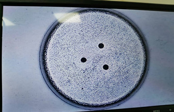 鑫濤源精密五金：醫療行業微小件沖壓卓越案例剖析