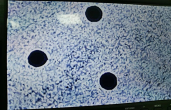 電子元件微孔加工案例：解決高頻信號傳輸難題